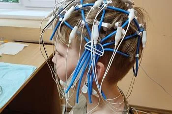 Около двух тысяч исследований проведено в течение года на новых электроэнцефалографов в Городской детской поликлинике Около двух тысяч исследований проведено в течение года на новых электроэнцефалографов в Городской детской поликлинике